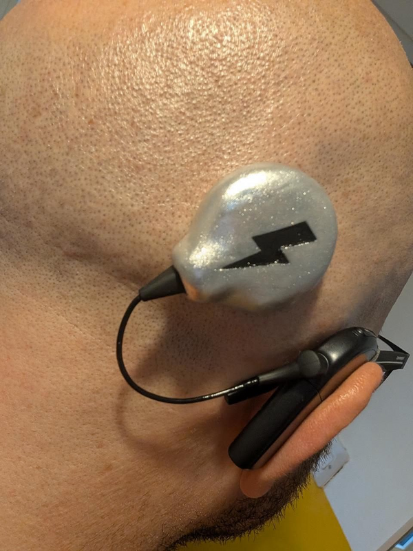 Stuart R. wearing an Auzi silver Spark Coil Icons cover on his cochlear implant coil